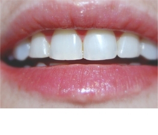 Ortodontica - specjalistyczna ortodoncja